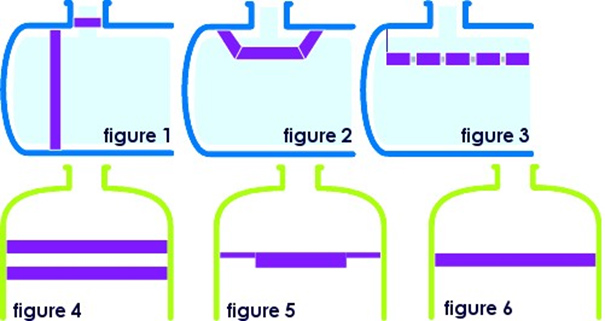 image of demisting system assembly